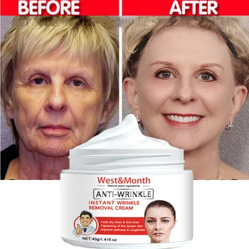 Instant Anti-wrinkle Tváre Krém Proti Starnutiu Sag Face Lifting Sprísnenie Krém Oživiť Vysokej Kvality kórejský Kozmetika 40g